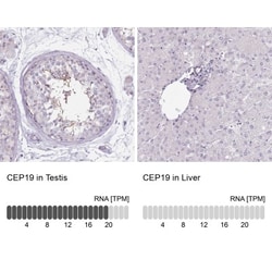 HSD5 Antibody, Novus Biologicals:Antibodies:Primary Antibodies
